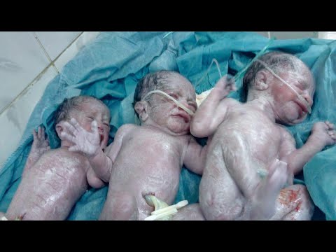 Babies LOST THE MOTHER in child birth and got a sad.. but EXCITING PHOTOGRAPHIC TEST