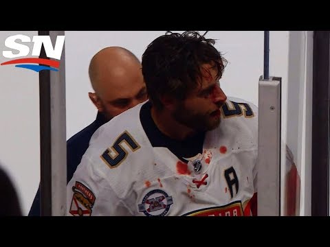 Max Domi Gets The Boot For Punching Out Aaron Ekblad