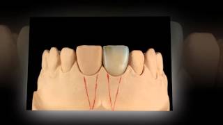 Sr Nexco Layering In Flames - Böröczky Attila