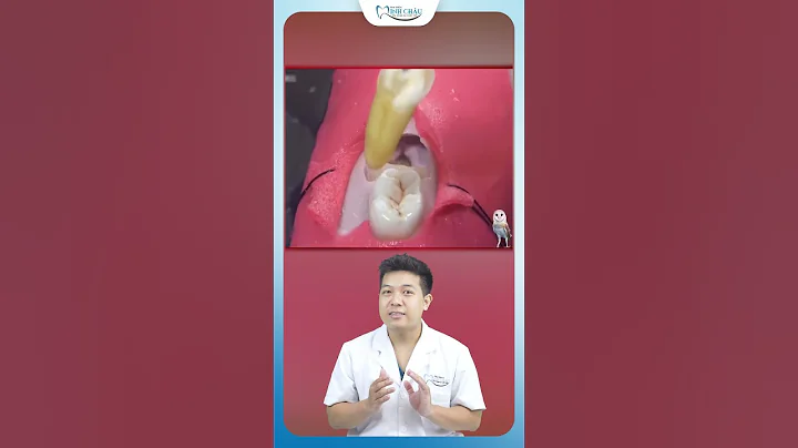 Wisdom Teeth Extraction Painful | Minh Chau Dental Clinic