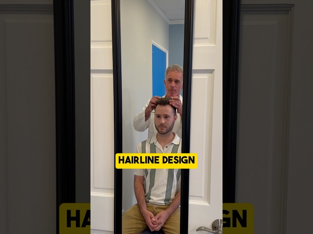 Hair Transplant Surgeon Designs a Natural Hairline!