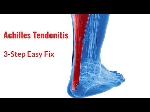 Video: How to Cure Headaches (Achilles Tendonitis)