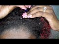 BIG FLAKES | DRY FLAKY SCALP | DANDRUFF SCRATCING Ep18 #dandruff #dryscalp