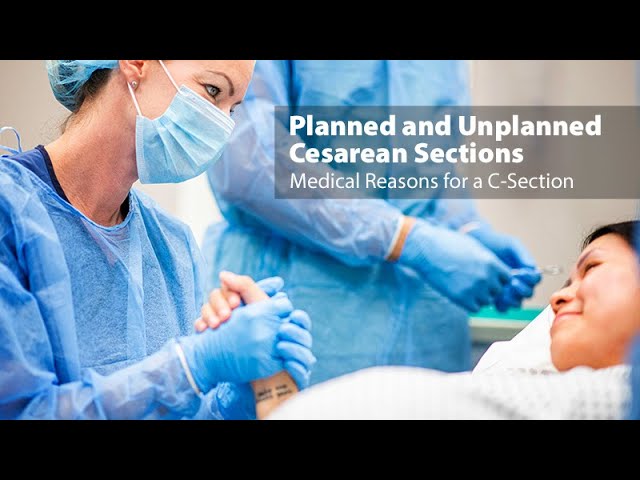 Planned and Unplanned Cesarean Sections: Medical Reasons for a C