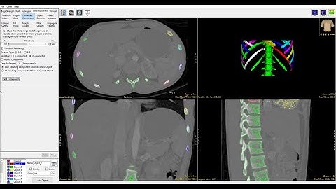 Analyze 15.0 - Segment: Connected Components