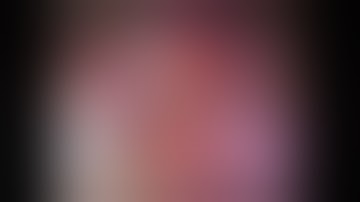 Thoracoscopic Segmentectomy for Pulmonary Sequestration