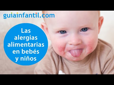 Video: Cómo Saber A Qué Es Alérgico Su Hijo