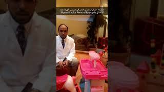 اضطراب و تزحزح مركز النمو في عظمة الورك عند الاطفال SCFE