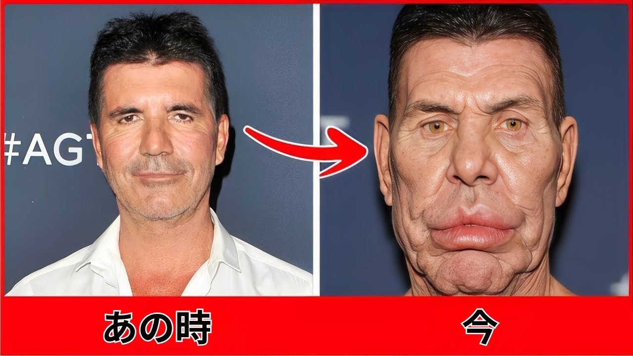 衝撃の男性芸能人整形ビフォーアフター7選！2025年の驚きの変化 - YouTube