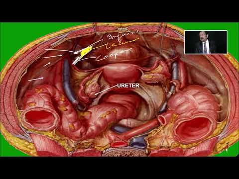 Laparoscopic Anatomy of Pelvis by Dr R K Mishra