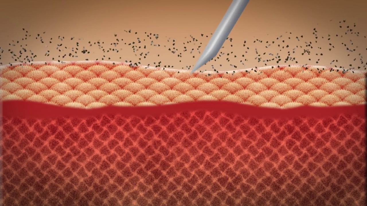 NEEDLE & M.O. PIERCING YouTube