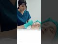 Steps to start your dimple transformation