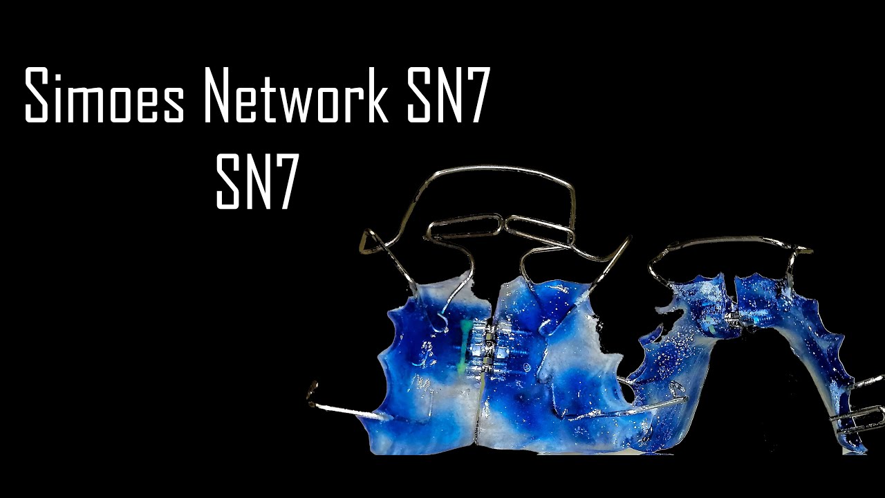 Elaboración de SN7 Simoes Network 7 | Elena Dental Art & More - YouTube