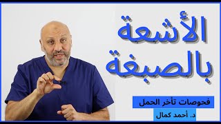 الحلقة (الأولي ) الأشعة بالصبغة للرحم والأنابيب