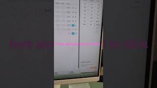 DGT - how to quickly scan autoclave barcode into core practice for dental assistant