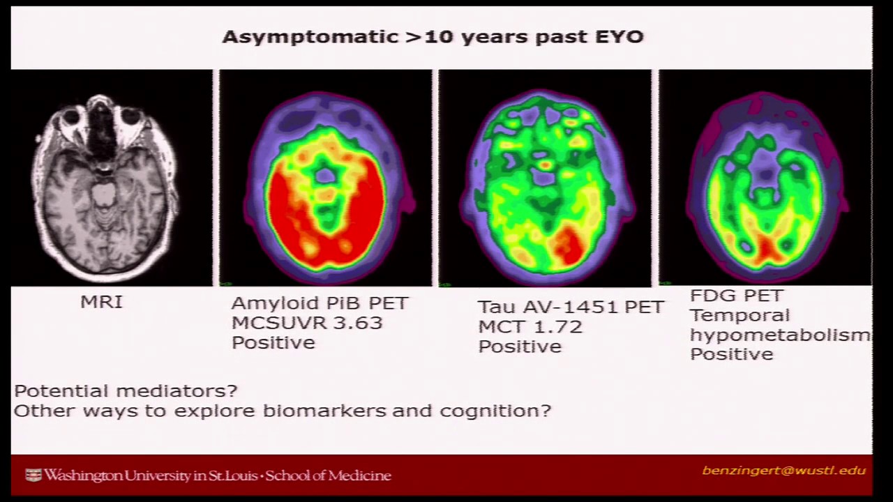 aging research conference Cognitive Aging Summit III | Dr. Tammie Benzinger
