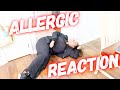 IS THIS CONCERNING (Allergic Reaction) | Family 5 Vlogs
