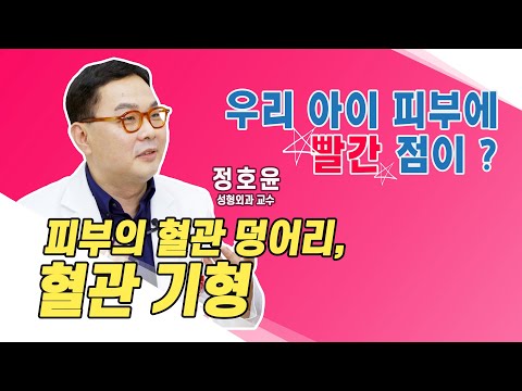 [닥터K] 🔴🔵혈관기형? 우리아이👶 피부에 이건 뭔가요? l 성형외과 정호윤 교수