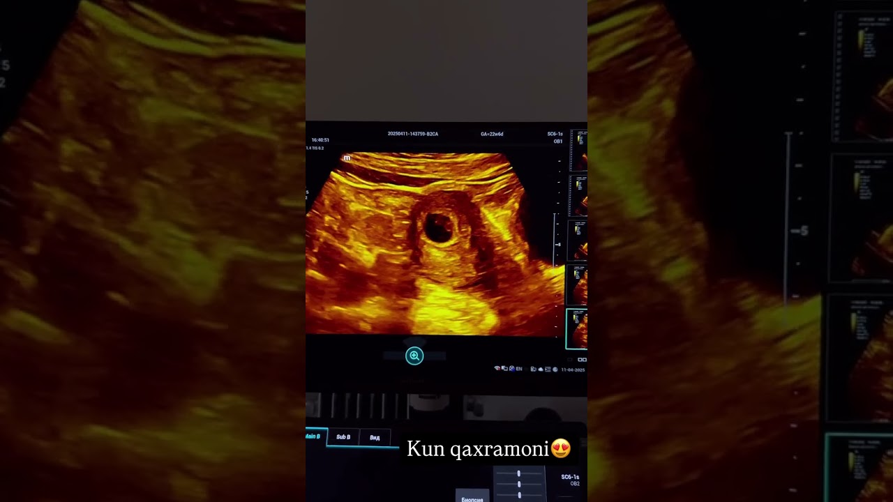 Kun qaxramoni spirali ustidan bo’b qogan bolajon #shortsvideo #ahorts #shorts