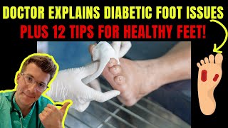 Doctor explains DIABETIC FOOT COMPLICATIONS - PLUS 12 TIPS FOR PREVENTION! screenshot 5