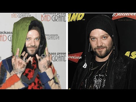 Bam Margera admitted to hospital with pneumonia