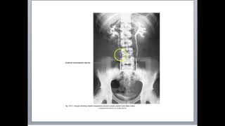 RADT 210 Urinary Positioning