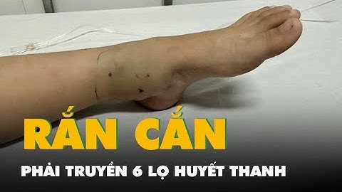 Truyền 6 lọ huyết thanh cứu bé gái 4 tuổi bị rắn lục đuôi đỏ cắn