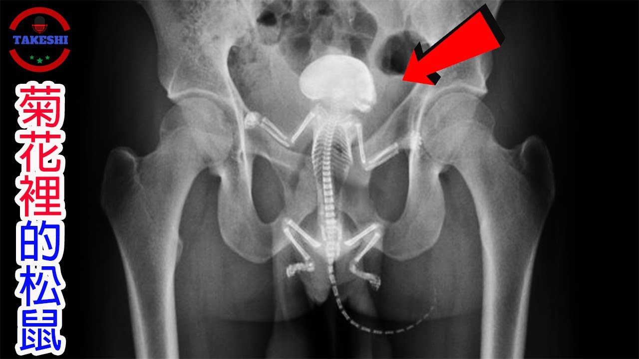 [生物放大鏡] X光下的松鼠與鼠王謎團的真相 | 屁股裡的生物危機 | 破解鼠王祕密的X光片