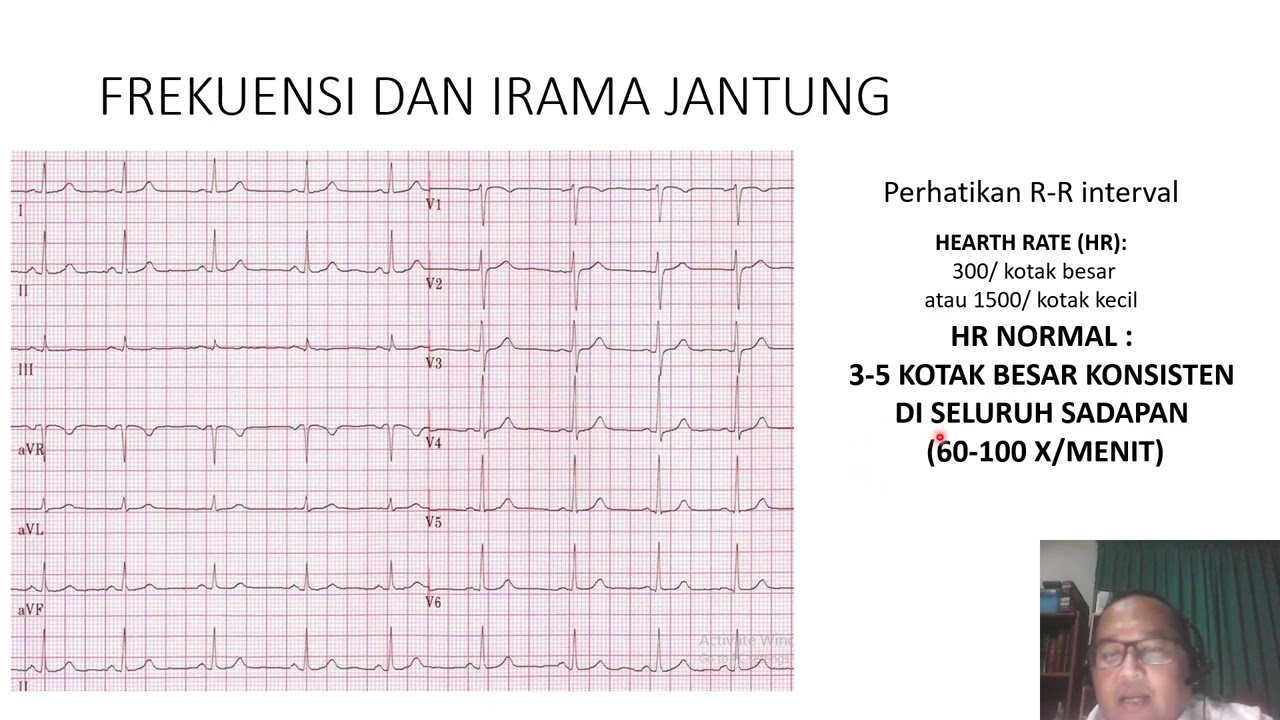Empat Jurus Dasar EKG/ Anti Ribet Baca EKG Bagian 2/Easy ECG part 2