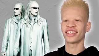 People With Albinism Review Albino Characters From Film