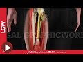 Hamstring Repair Surgery 3D animation