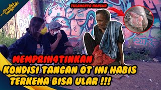 TANGAN OT INI MEMBUSUK KARENA GIGIT4N ULAR COBRA?? HARUS 4MPUTASI?? | PRATIWI NOVIYANTHI
