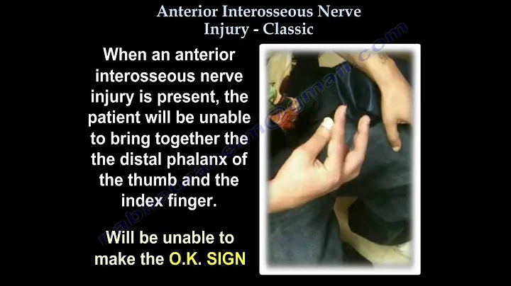 Anterior Interosseous Nerve Injury Classic - Everything You Need To Know - Dr. Nabil Ebraheim - DayDayNews