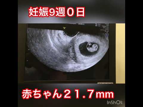 妊娠7週目と 10日後のエコーを比べてみた Youtube