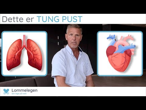 Video: Den Diagnostiske Verdien Av Bronkoalveolar Skylling Ved Interstitielle Lungesykdommer