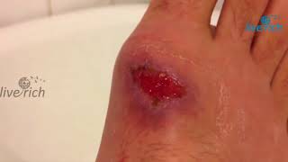 LR Aloe Vera спрей "Скорая помощь"- заживляет открытые раны LR Aloe Vera спрей "Скорая помощь"- заживляет открытые раны