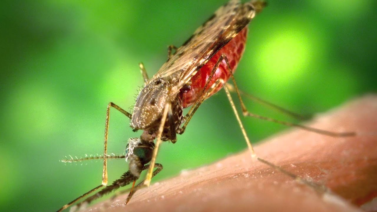 Bahaya Penyakit Kaki Gajah - YouTube