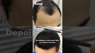 12   Cabelos de Boneca