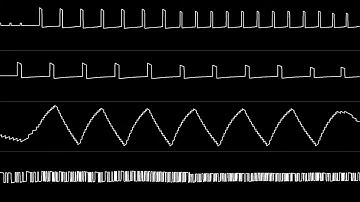 Tim Follin - "Solstice (NES) - Title Theme" [Oscilloscope View] (acrouzet)