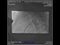 Takrim 1 Y 11 M 10Kg PDA device closure