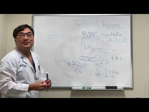 Video: Retinal Hemorrhage - Causes, Symptoms And Treatment