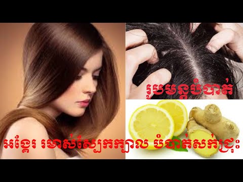 Easy hair mask recipes for hair loss treatment | វិធីបំបាត់រមាស់ អង្គែរស្បែកក្បាលនិងសក់ជ្រុះ