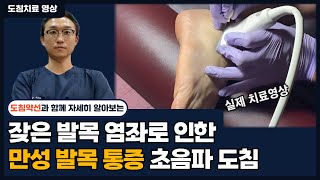 [치료영상] 잦은 발목 염좌로 인한 만성 발목 통증 초음파 도침치료