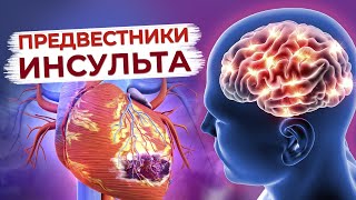 Предвестники инсульта / Профилактика болезней сердца без лекарств