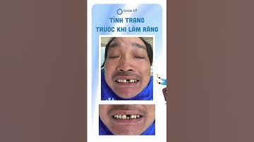 Nụ cười mới, cuộc sống mới 😎 I Nha Khoa Smile HT
