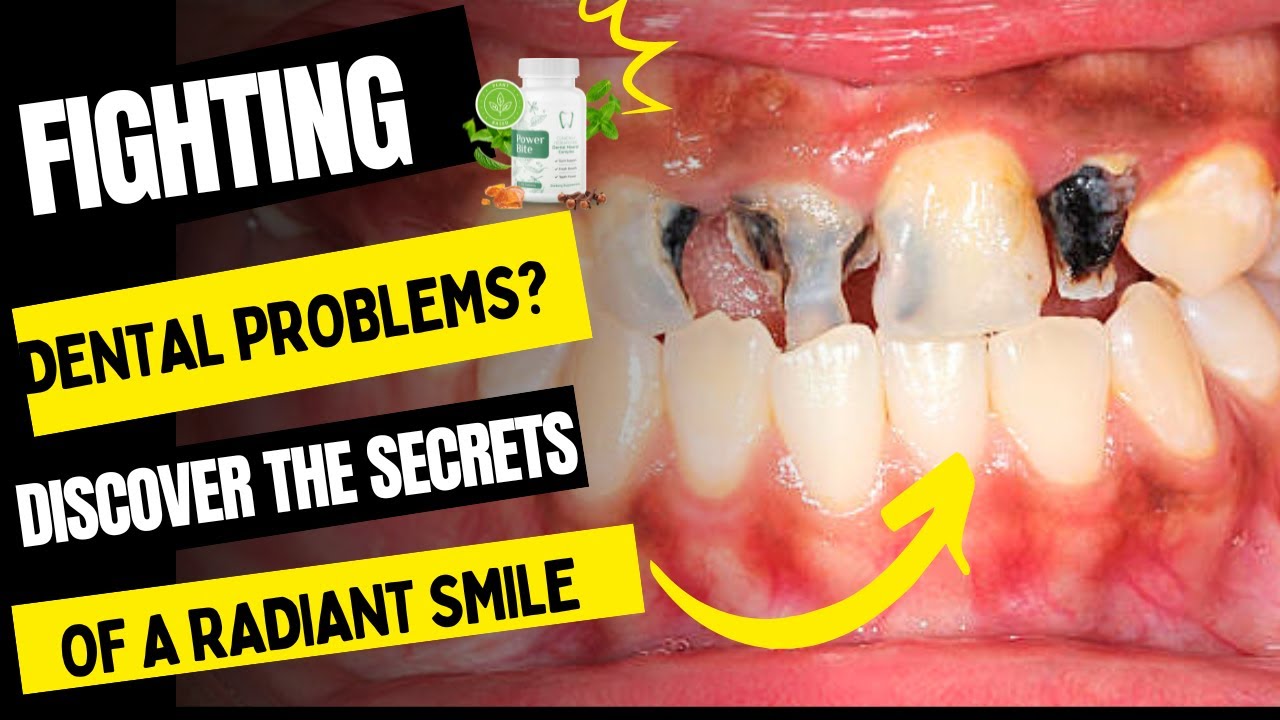 Powerbite – ⚠️ALERT⚠️ – Powerbite Reviews | 😱Secrets Revealed😱