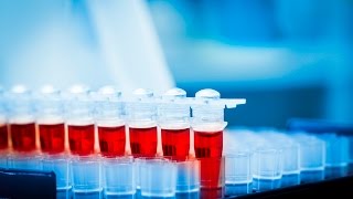 Sharing Genetic Risk Information May Help Motivate Weight Loss Profile