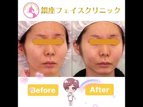 エラ張り の新着タグ記事一覧 Note つくる つながる とどける