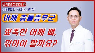 어깨 충돌증후군, 뼈를 깎는 수술이 필요할까요? @제애정형외과- (구)금메달정형외과