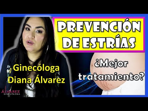 Vídeo: Cómo Prevenir Las Estrías: 7 Consejos